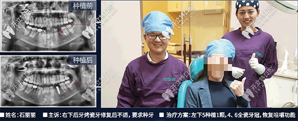 昆明尚愛(ài)韓美李兵做韓國(guó)dentium<span style=