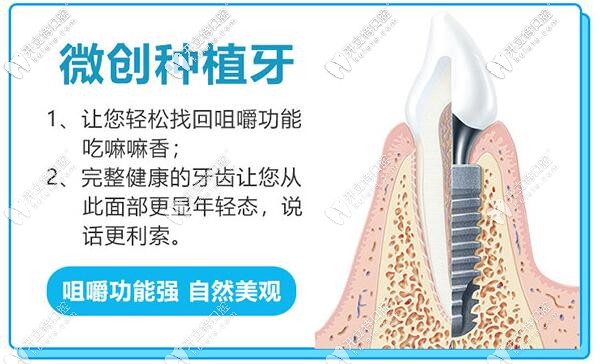 廣州穗江口腔微創(chuàng)即刻種植牙技術(shù)
