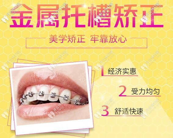 深圳希奧口腔金屬托槽牙齒矯正