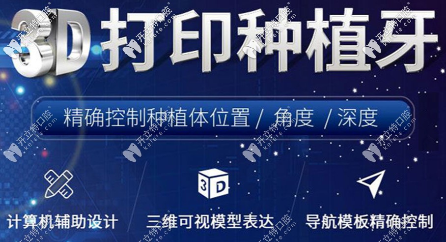 3D打印種植牙技術