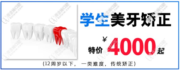 在淮安牙知道做mrc兒童矯治器價格低到4000起-活動沒幾天了