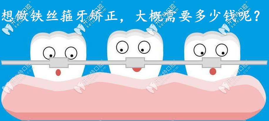 鐵絲箍牙大概需要多少錢?成年人和小孩子矯正的費(fèi)用都想要