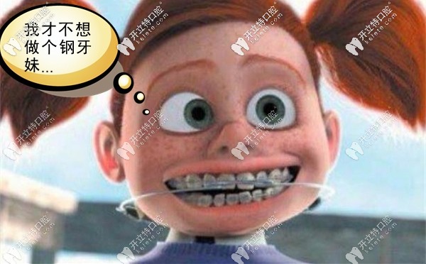 我選擇箍牙矯正的原因