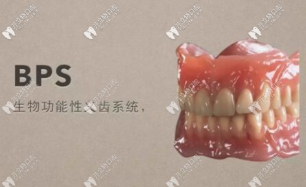 bps生物功能吸附性義齒與普通全口假牙的區(qū)別只是價格貴點?