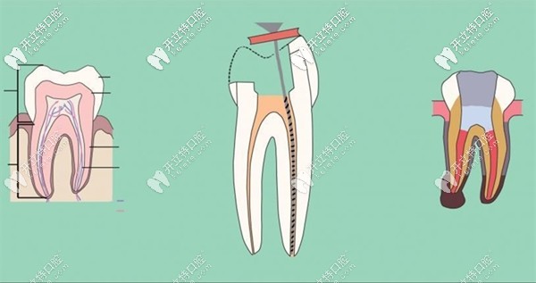 暨南雅皓口腔的看牙價(jià)格