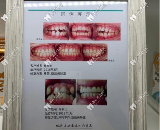 株洲南光口腔案例展示