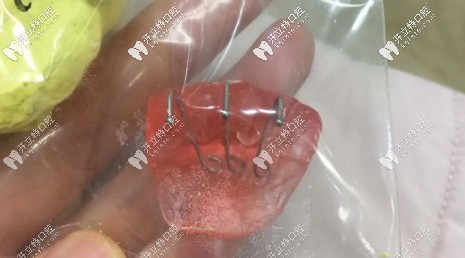 時隔8個月，用上了平導和骨釘