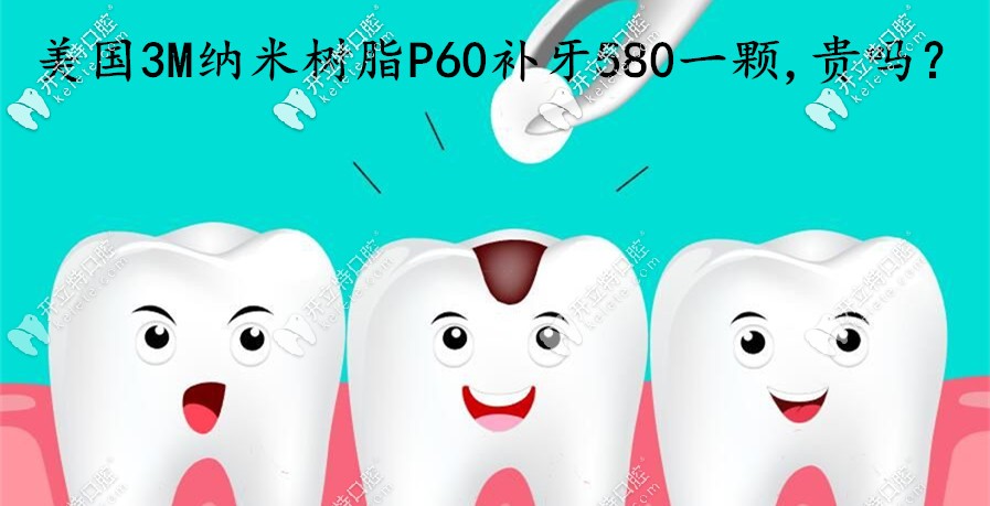 在煙臺做美國3MP60納米樹脂補(bǔ)牙580一顆，這費(fèi)用算貴嗎