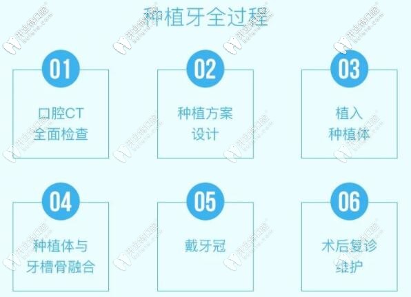 秦皇島藍(lán)天口腔種植牙過程圖 秦皇島藍(lán)天口腔種植牙過程圖