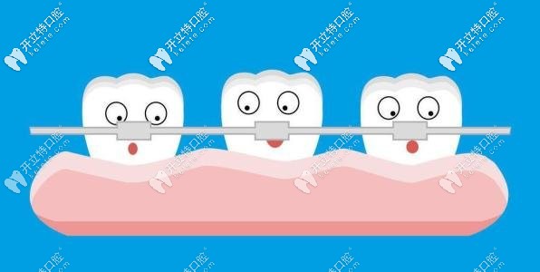 在義烏做comfos青春版無托槽隱形牙套的價格終于被挖到啦