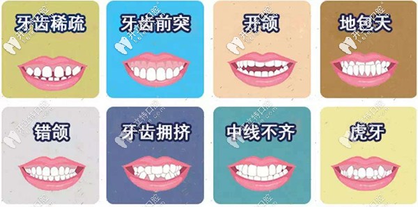 金屬托槽矯正適應癥