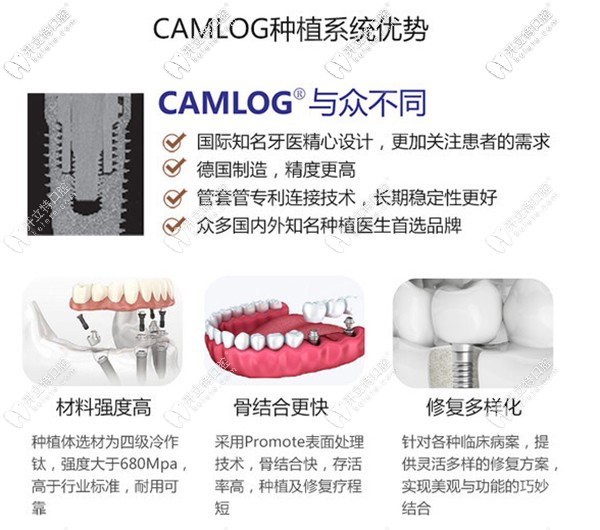 德國camlog種植體有哪些優(yōu)點