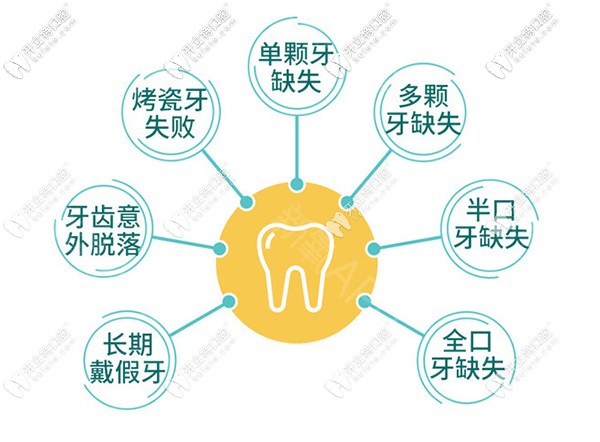 韓國奧齒泰系統(tǒng)適應癥