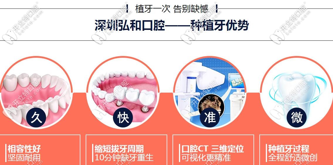 深圳弘和口腔種植牙優(yōu)勢(shì)