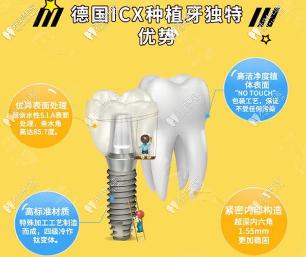 ICX種植體優(yōu)勢