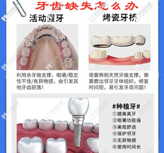 牙齒缺失怎么辦