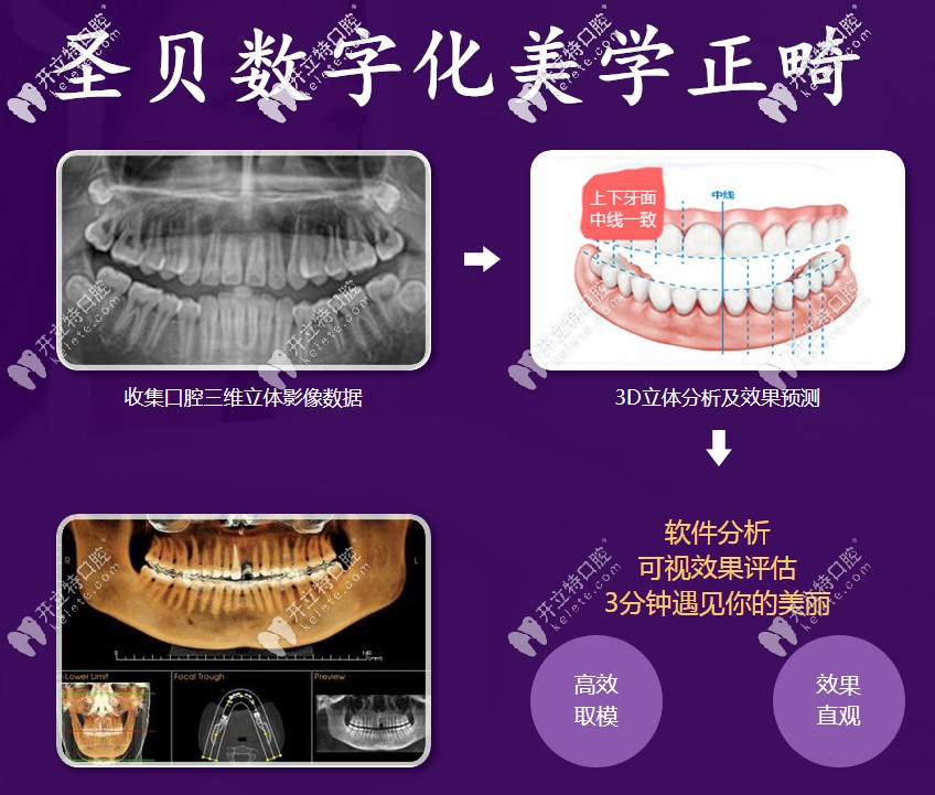 數(shù)字化牙齒矯正流程