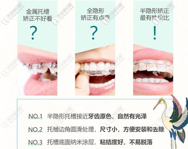 半隱形矯正咋樣