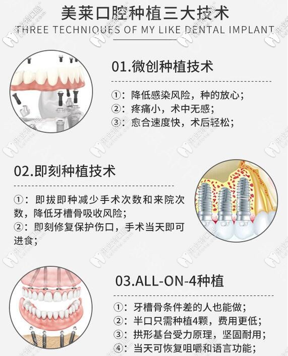 深圳美萊口腔3大種植牙技術(shù)