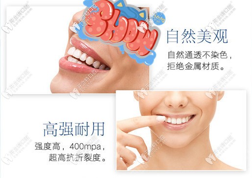 二氧化鋯全瓷牙的優(yōu)勢(shì)