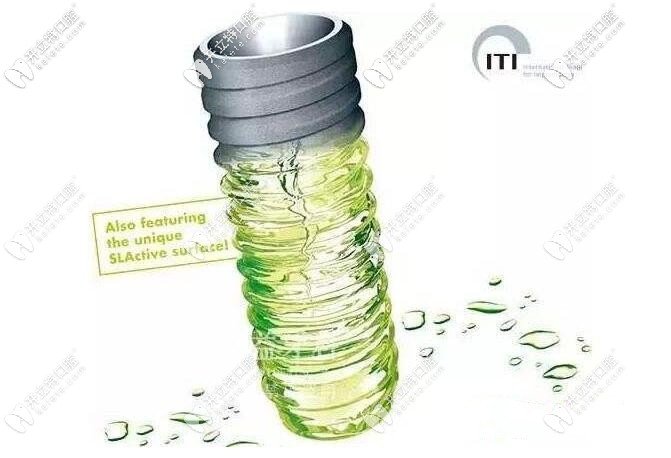 瑞士ITI種植牙系統(tǒng)優(yōu)勢(shì)