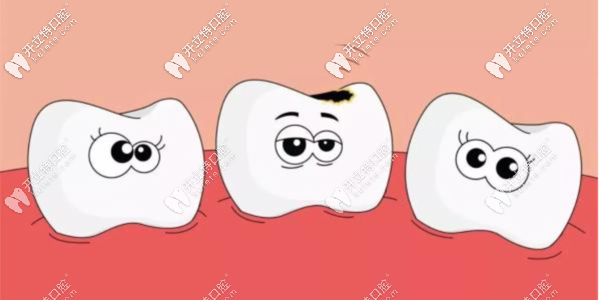 齲齒就要早發(fā)現(xiàn)早解決