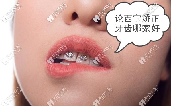進(jìn)來(lái)聊聊關(guān)于西寧市做牙齒矯正哪家牙科醫(yī)院好這個(gè)話題