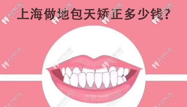 想知道在上海正規(guī)牙科做地包天矯正的費(fèi)用大概是多少嗎？