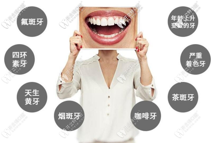 前牙美學(xué)修復(fù)適應(yīng)癥