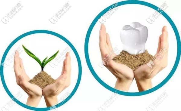 廣州做一顆種植牙的費用多少