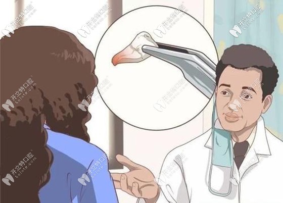 不同的口腔情況種牙價(jià)格也不同