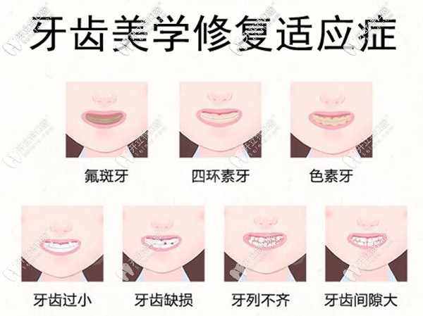 賀州微笑口腔牙齒美學(xué)修復(fù)適應(yīng)癥
