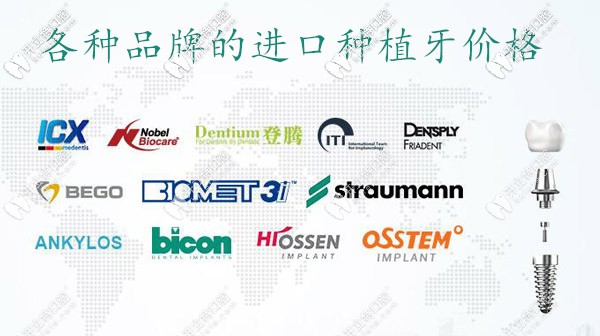 東莞牙科的種植牙收費(fèi)價(jià)目表,從單顆到全口,這個(gè)價(jià)格很合理