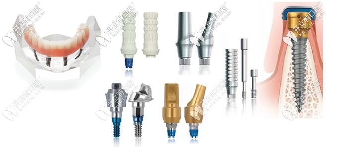 美國(guó)杰美種植體