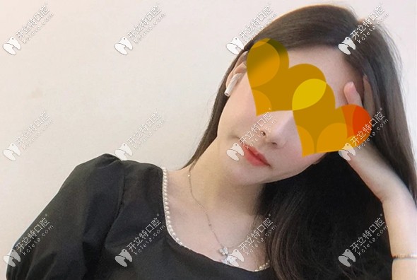 吳小姐做完正頜術(shù)后3個(gè)月圖