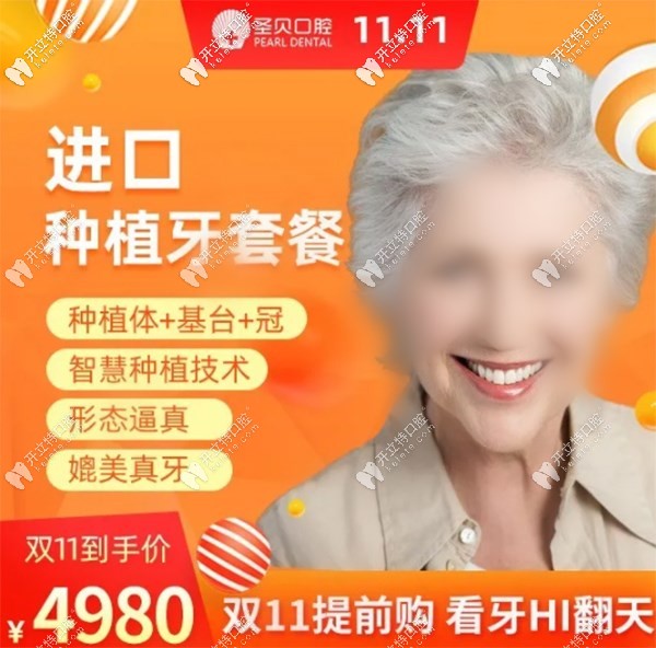 北京朝陽圣貝做韓系進(jìn)口種植牙價位4980元起，雙11buy