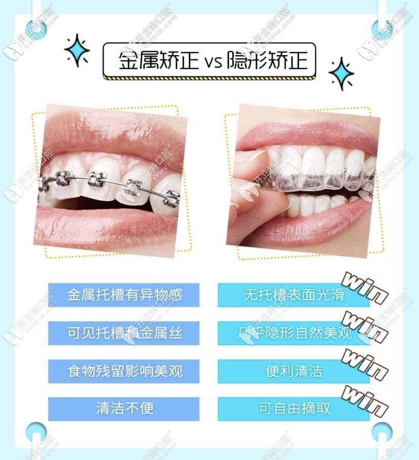 金屬牙套VS隱適美牙套