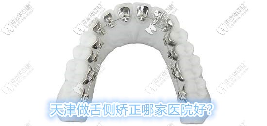 整理出一份天津做舌側(cè)矯正技術(shù)比較好的醫(yī)院,附醫(yī)生推薦哦