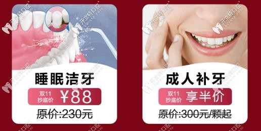 成人補(bǔ)牙、潔牙活動