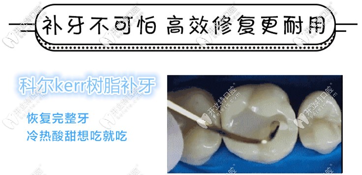 美國科爾kerr樹脂補(bǔ)牙多少錢一顆,與3m價位相差大嗎？