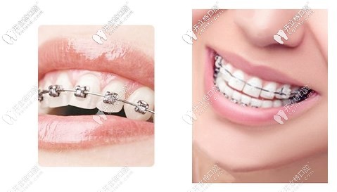 深扒了德陽口腔醫(yī)院價格表，這樣的收費標準你中意么