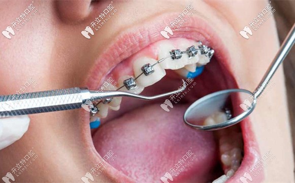 趙郡凡醫(yī)生的擅長項(xiàng)目介紹