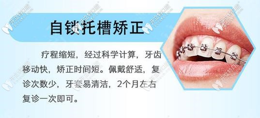 金屬自鎖牙套矯正器優(yōu)勢