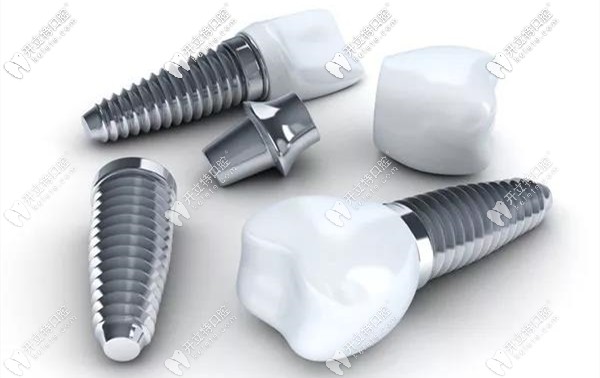 廣州番禺區(qū)三仁口腔的種植牙價格很超值哦