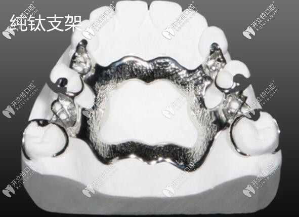 全口純鈦活動(dòng)義齒