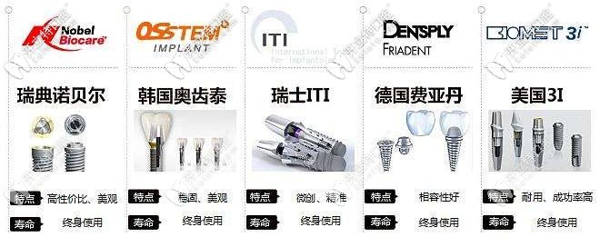 不同品牌種植體的特點和壽命