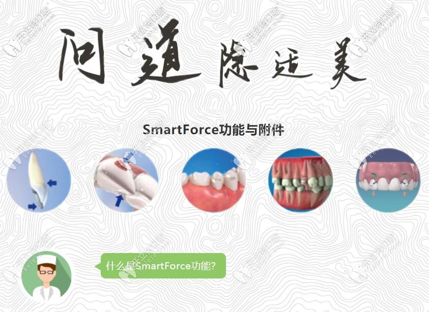 為啥醫(yī)生矯正骨性齙牙更偏愛應(yīng)用隱適美SmartForce呢
