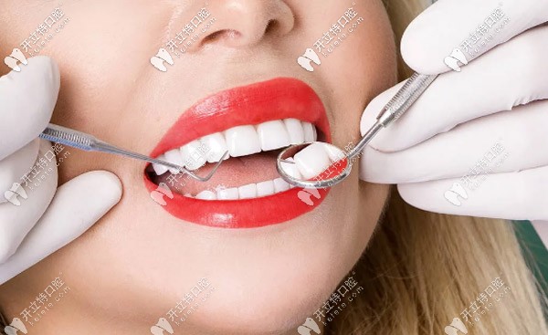 牙齒貼面修復(fù)一般可以維持5-10年