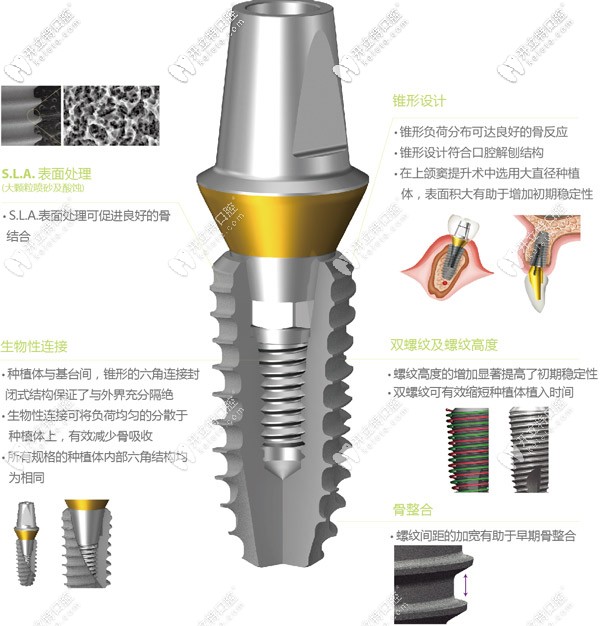 韓國superline種植系統(tǒng)的特點