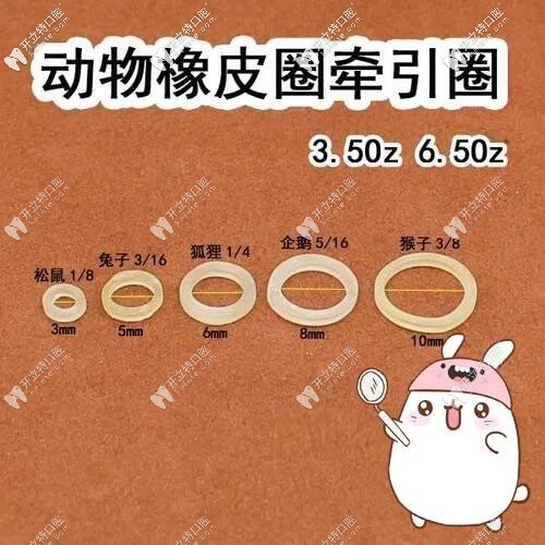 正畸橡皮圈型號和力量